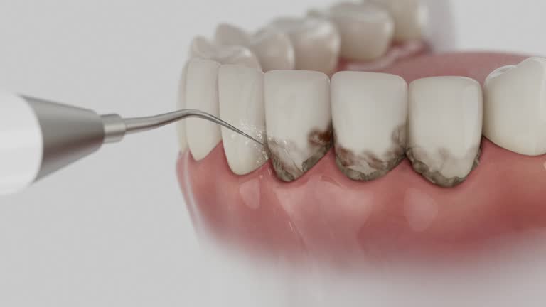 Reliable Dental contractor in Mount Olive, AL by Smile Center Dentistry